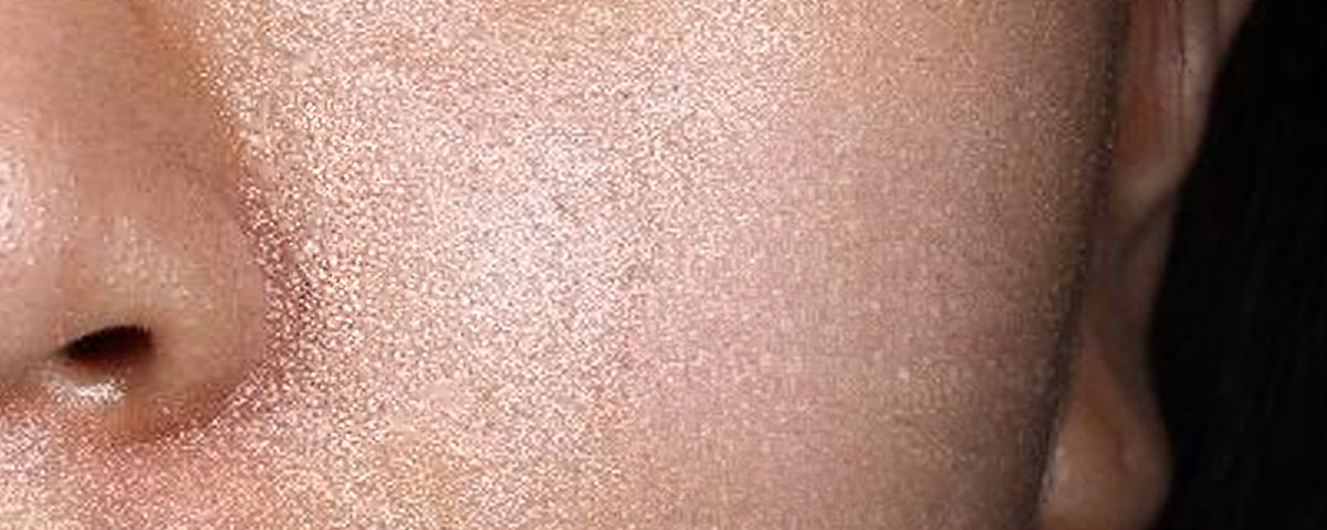 Luminosité — after