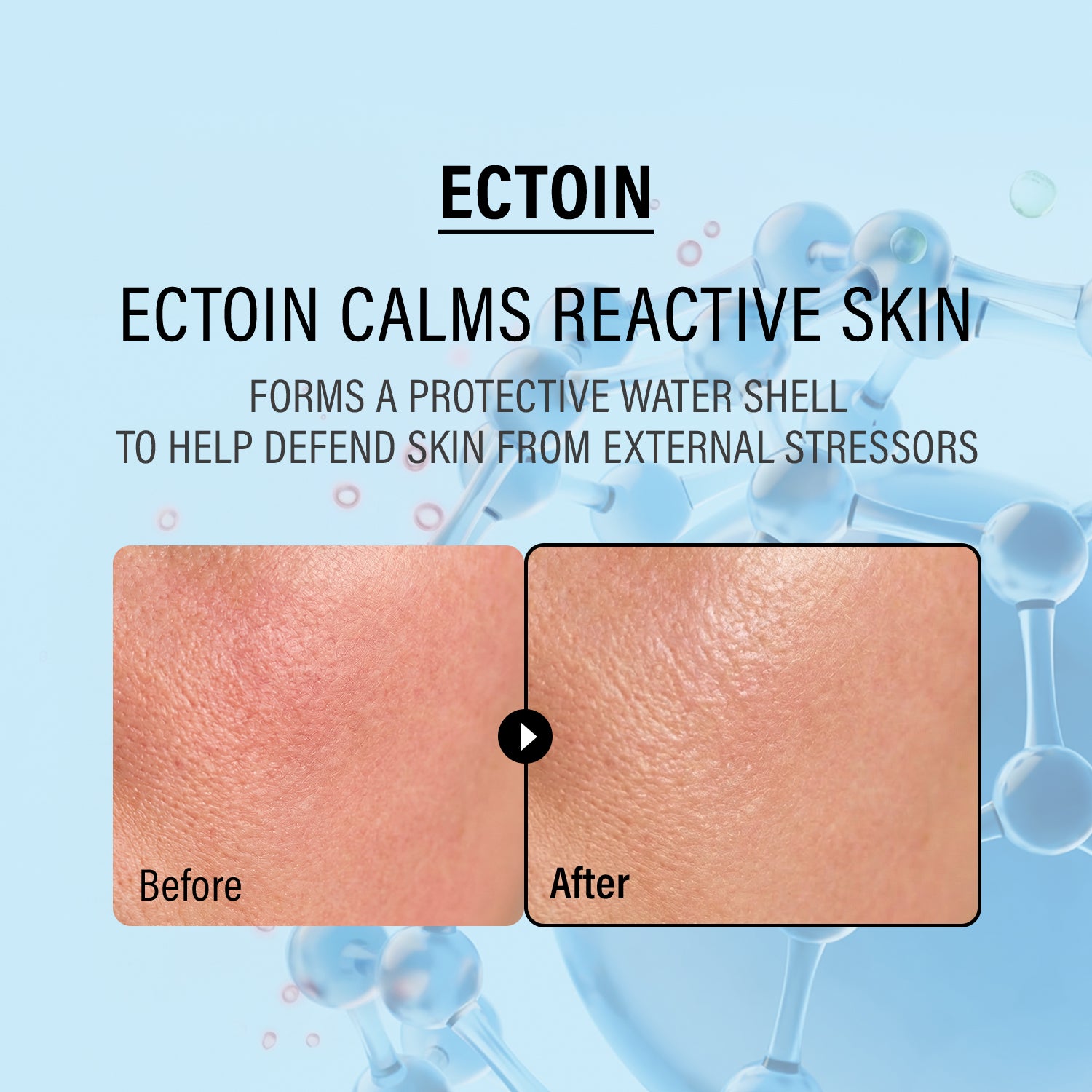 Double Up Cream - Ectoin & Panthenol