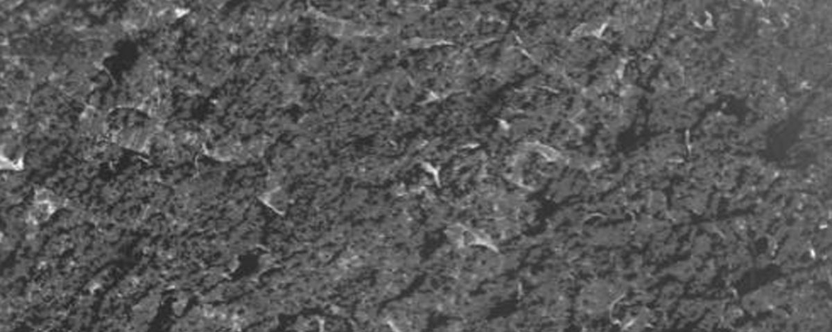 Skin density — before